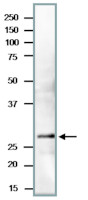 PCNA | Proliferating cell nuclear antigen (Saccharomyces cerevisiae) in the group Antibodies Other Species / Fungi at Agrisera AB (Antibodies for research) (AS21 4552)